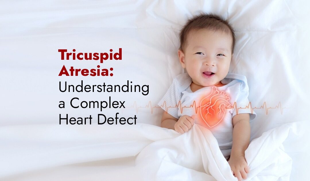 Tricuspid Atresia: Understanding a Complex Heart Defect