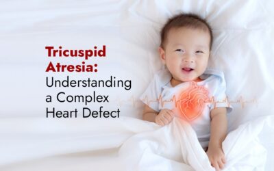 Tricuspid Atresia: Understanding a Complex Heart Defect