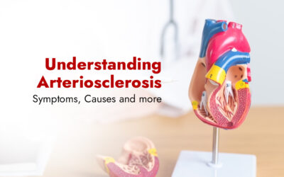 Understanding Arteriosclerosis – Symptoms, Causes and more