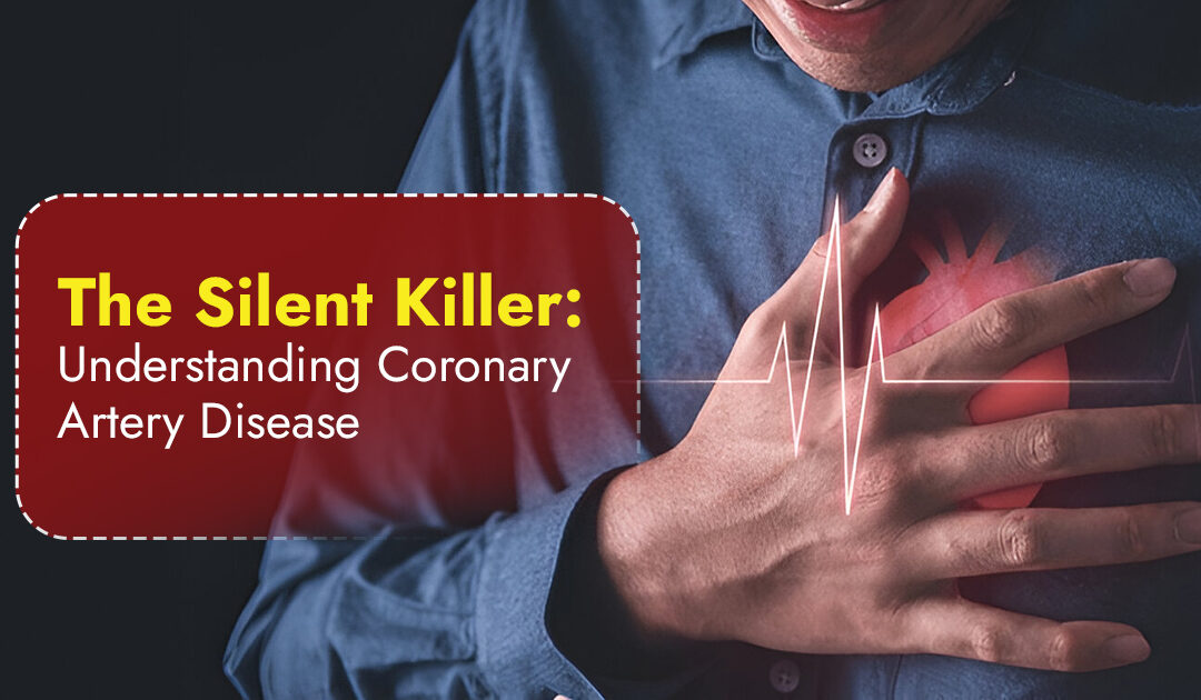 The Silent Killer: Understanding Coronary Artery Disease